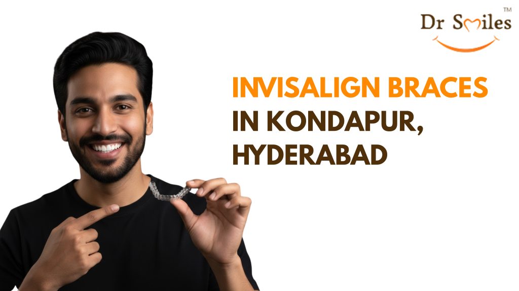 Invisalign Braces in Kondapur