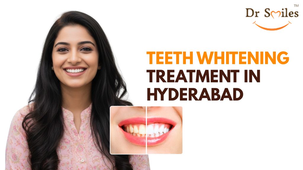Teeth Whitening Treatment in Hyderabad