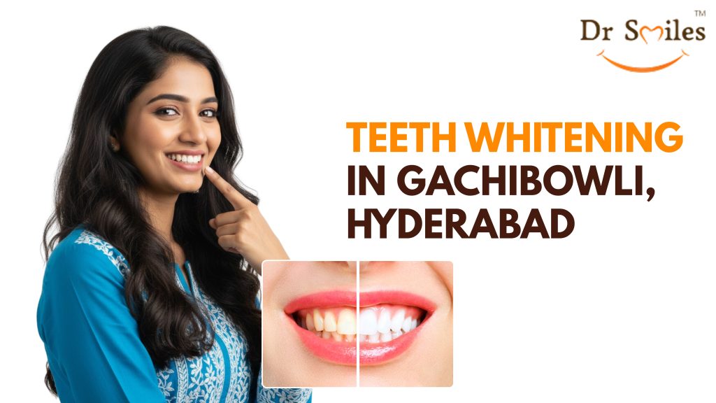 Teeth Whitening in Gachibowli