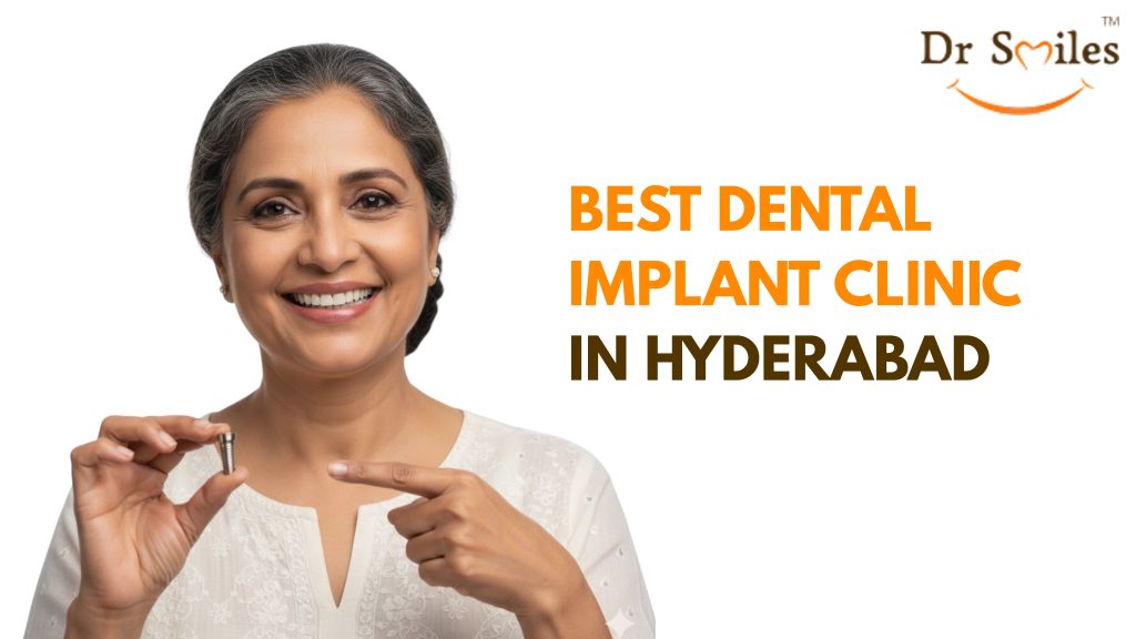 Best Dental Implant Clinic in Hyderabad
