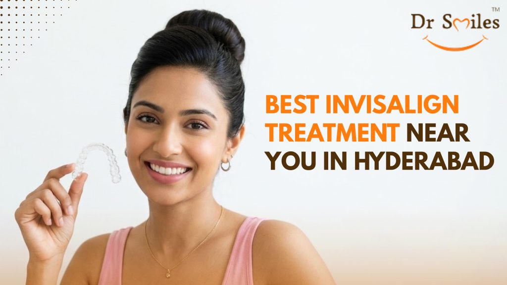 Best Invisalign Treatment in Hyderabad