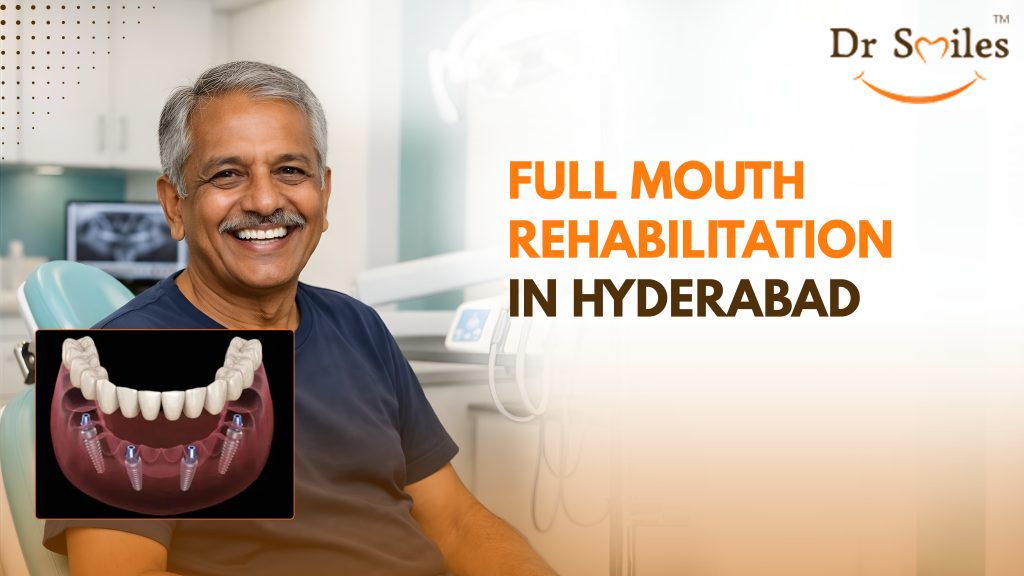 Full Mouth Rehabilitation in Hyderabad