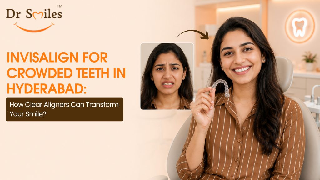 Invisalign for Crowded Teeth in Hyderabad